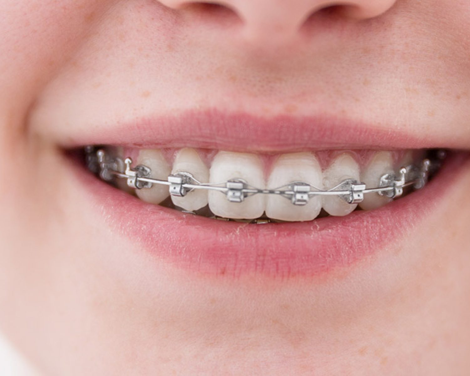 zahnarzt-froendenberg-hemmerde-zzr-content--kinder